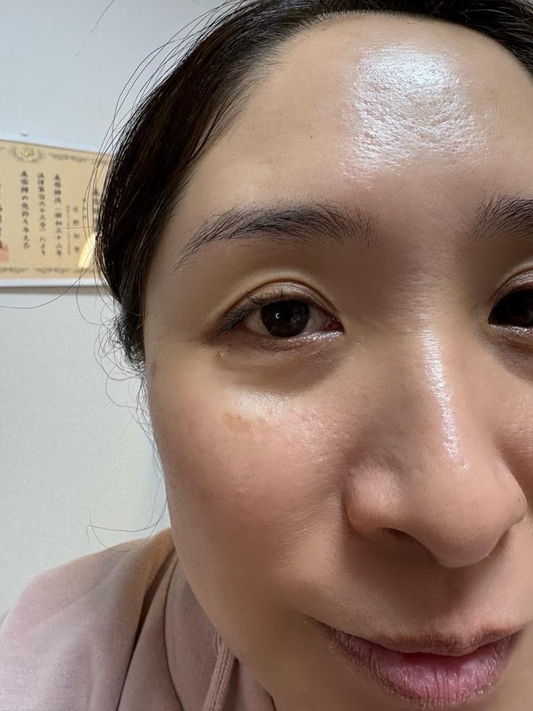 Before ラッシュリフト